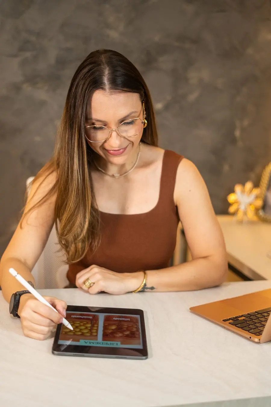 Carina Maiolli estudando o lipedema em atendimento